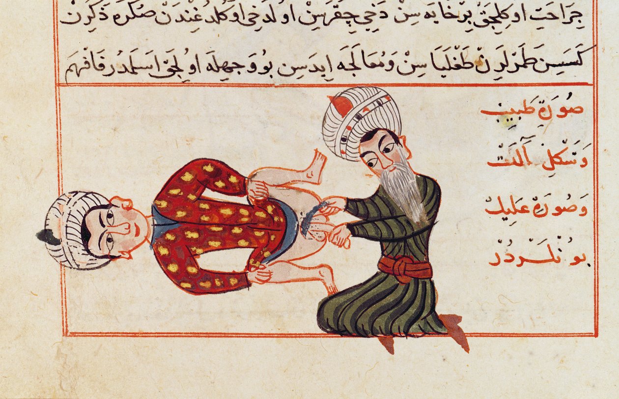 Ms Sup Turc 693 fol.76v Operation zur Kastration, 1466 von Charaf ed Din