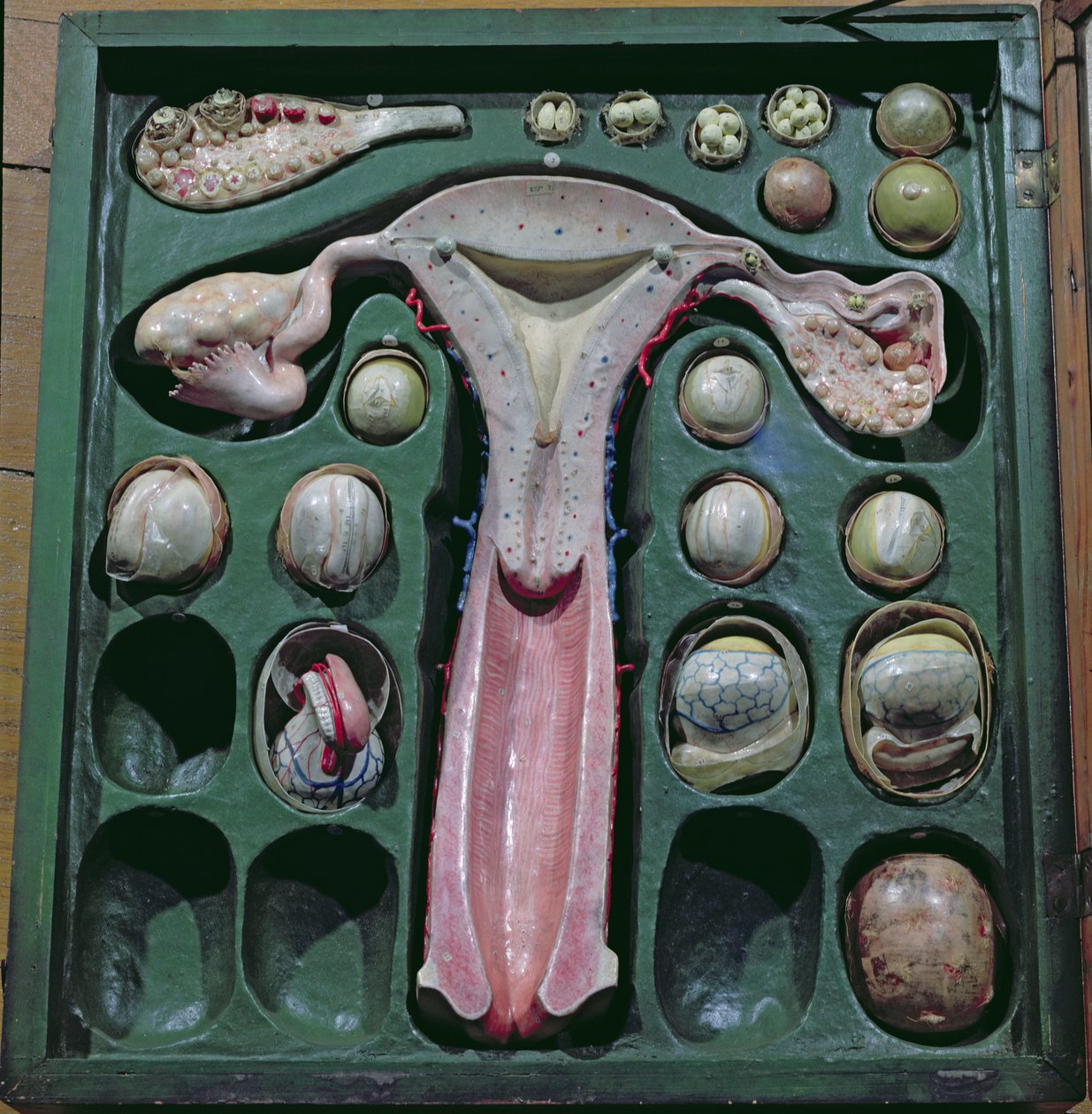 Weibliche Genitalien, ca. 1830 von French School
