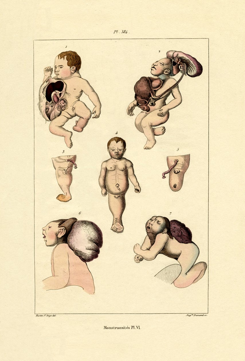 Freak von French School