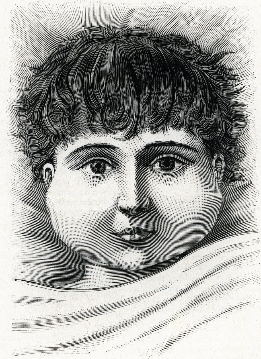 Kind mit Mumps (Gravur) 1888 von French School