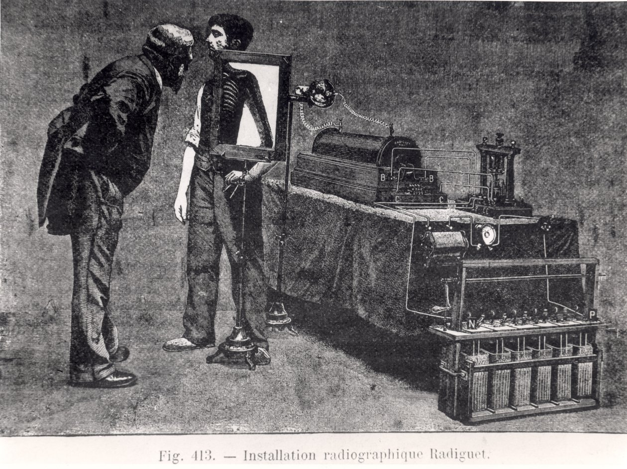 Radiguet-Röntgenmaschine von French School