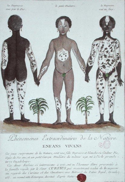 Das Phänomen der Leukodermie von French School