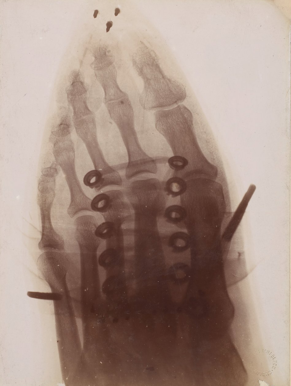 Der Fuß durch den Schuh von Henri van Heurck