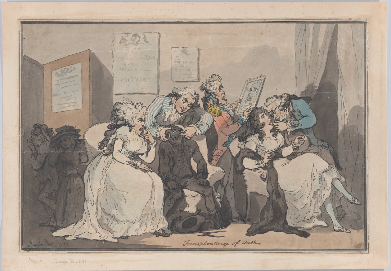Zahntransplantation, 1787 von Thomas Rowlandson
