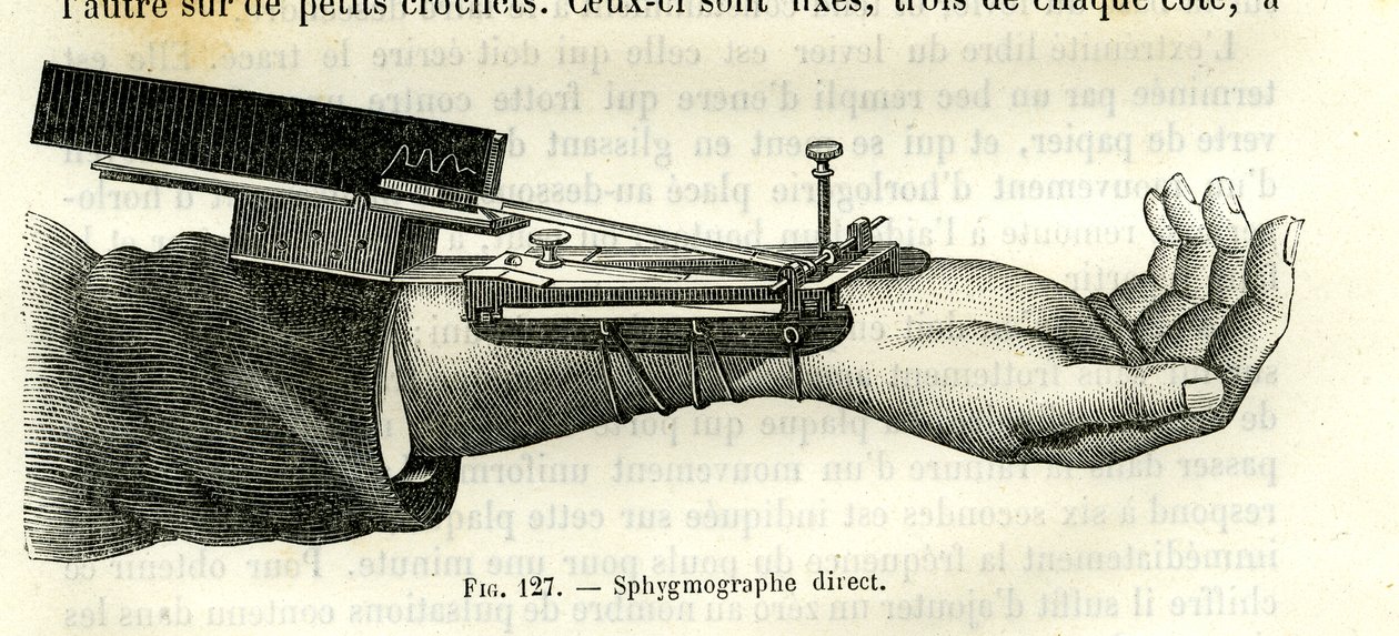 Direkter Sphygmograph von Unbekannter Künstler