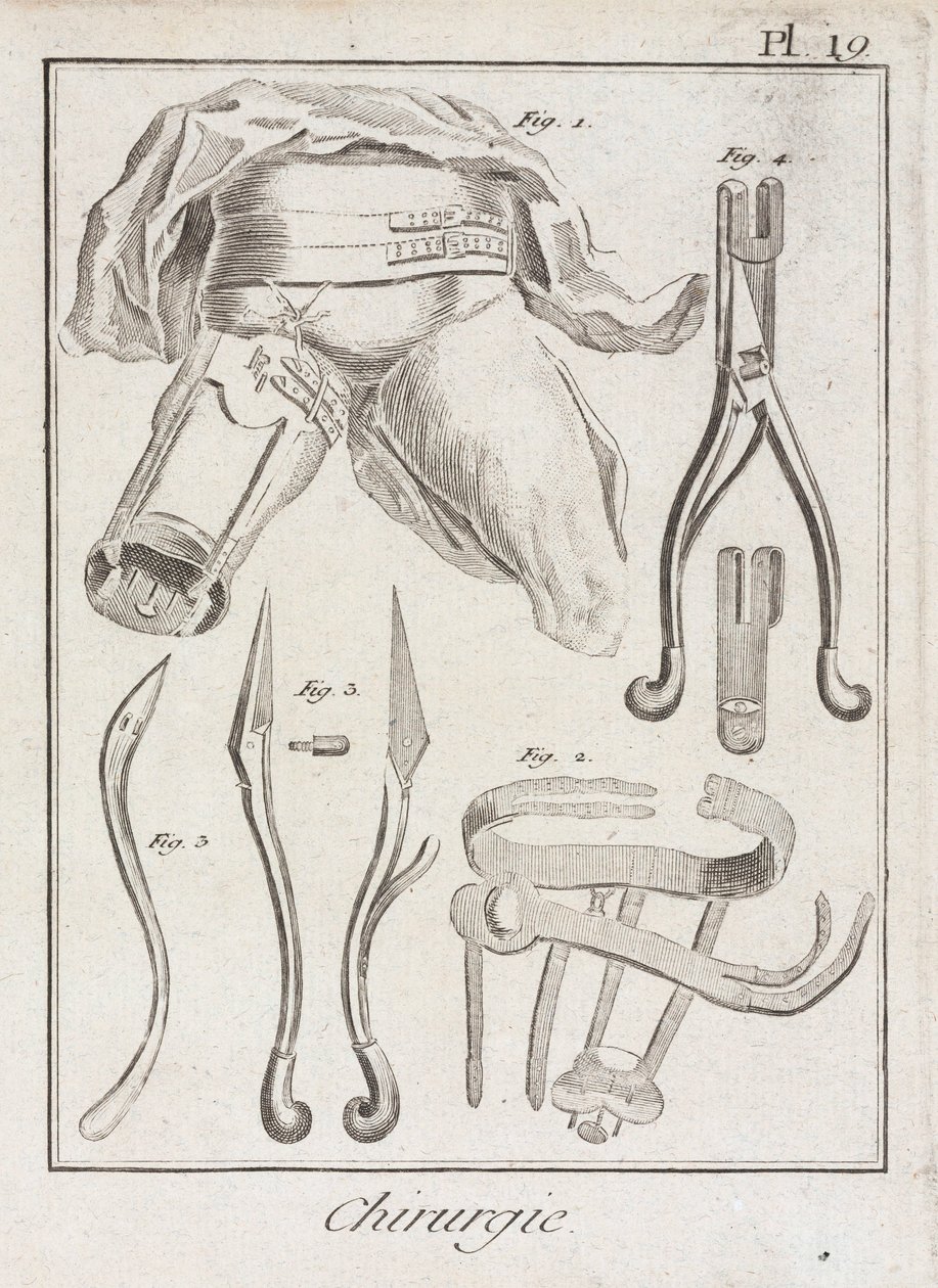 Frühneuzeitliche orthopädische Chirurgie von Unbekannt