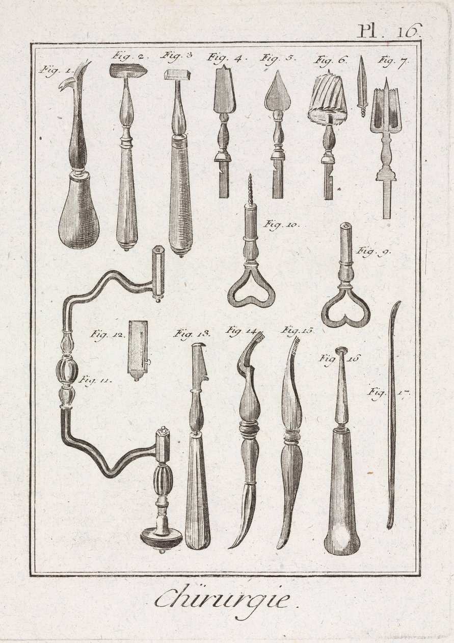 Trepanation Instrumente von Unbekannt