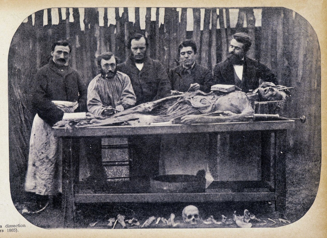 Dissektion, ca. 1865 von Unknown photographer