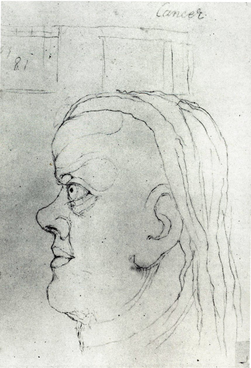 Kopf des Krebses von William Blake