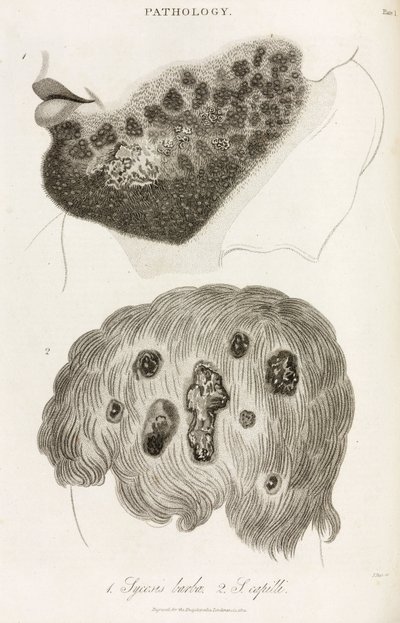 Dermatologie Hautkrankheiten von John Pardon