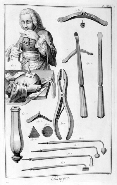 Kopfoperation, 1751-1777 von Unbekannt