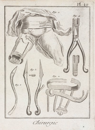 Frühneuzeitliche orthopädische Chirurgie von Unbekannt