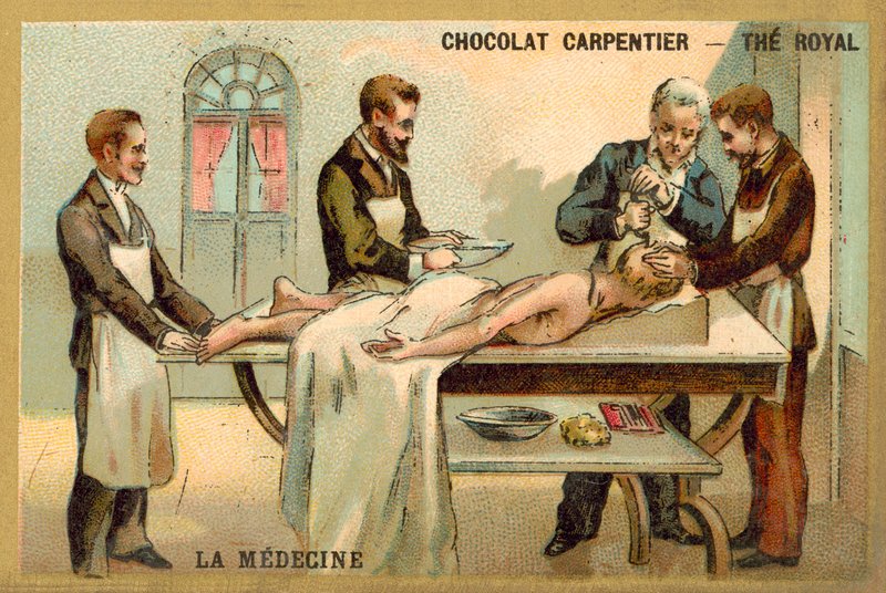Trepanation von French School
