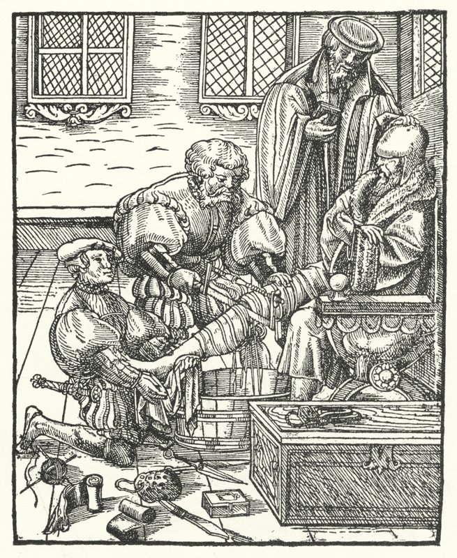 Eine Amputation (Gravur) von German School
