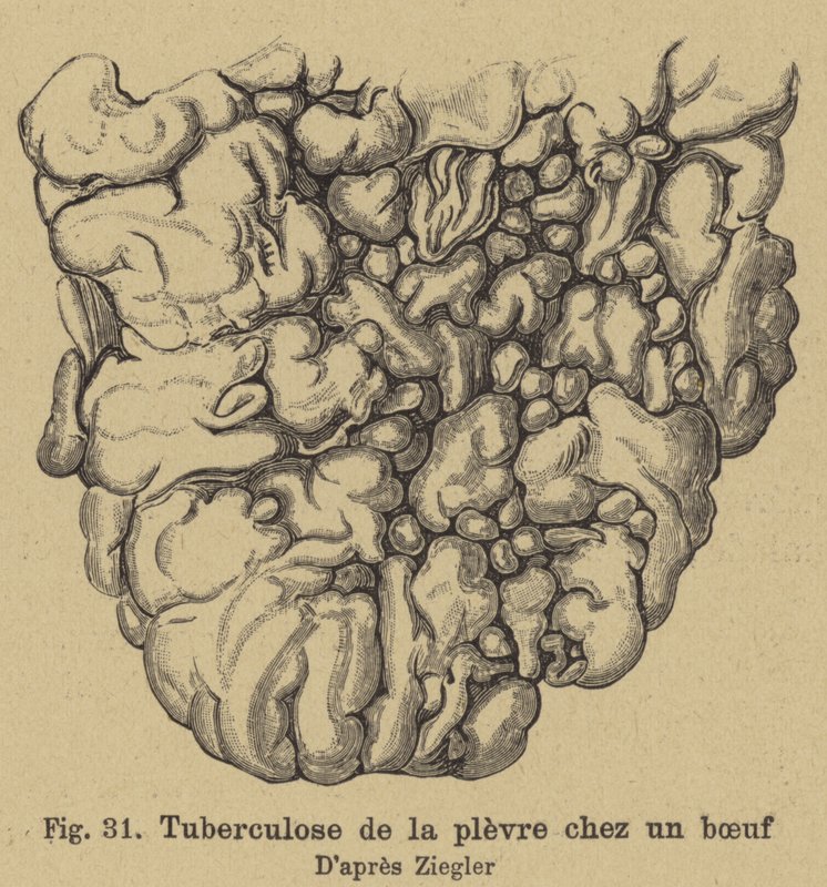 Rindertuberkulose von German School