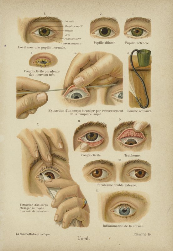 Das Auge von German School